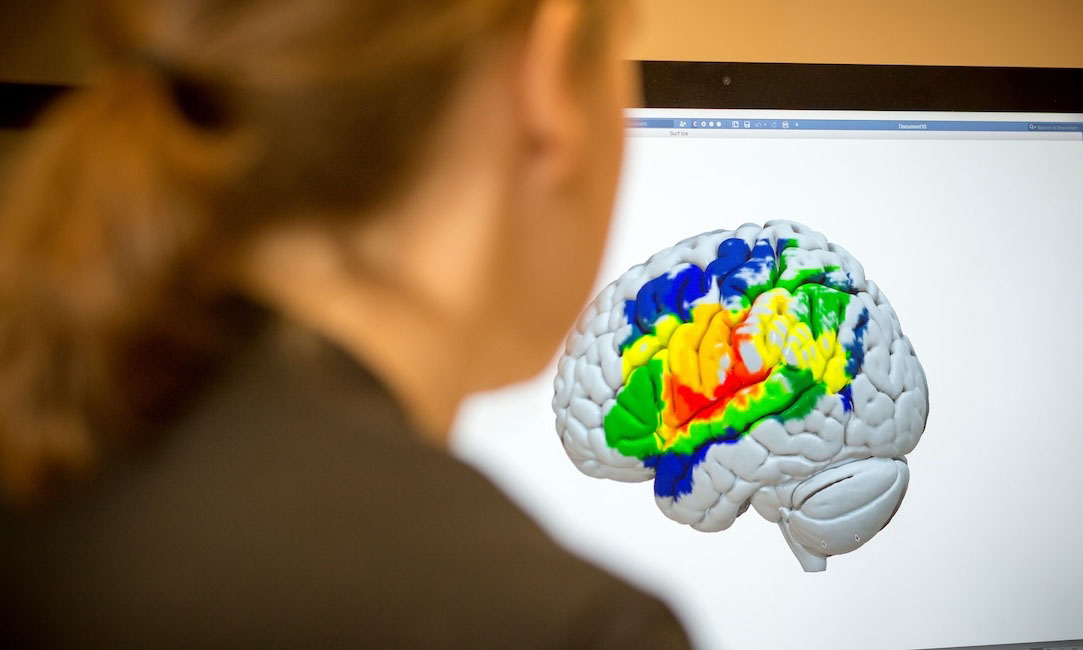 A researcher looks at an image of a brain